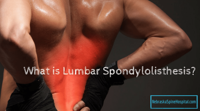 Lumbar Spondyloisthesis