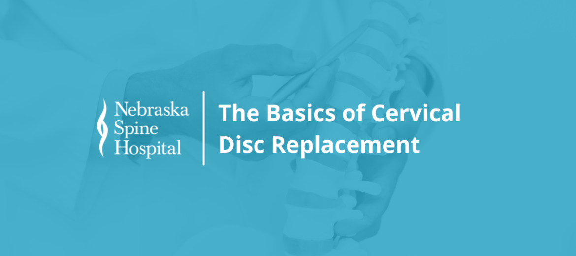 The Basics of Cervical Disc Replacement