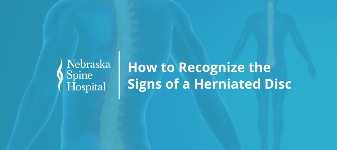 How to Recognize the Signs of a Herniated Disc